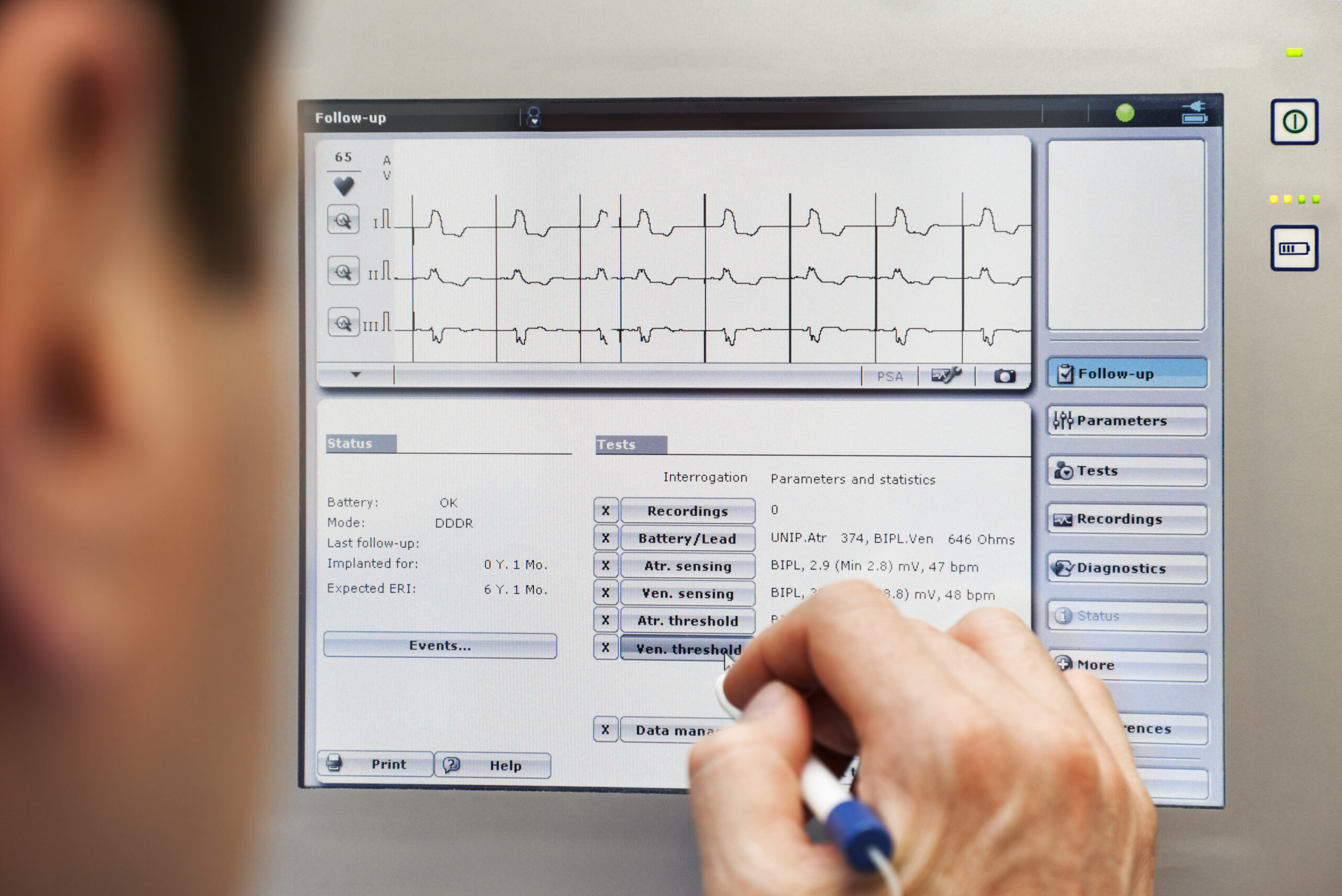 Closeup of programming a cardiac device